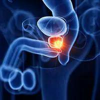 Study shows prostate MRI quality varies greatly across global sites