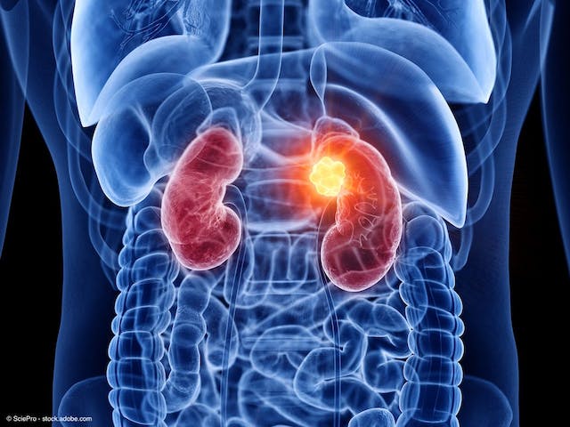 medical depiction of human kidneys on xray