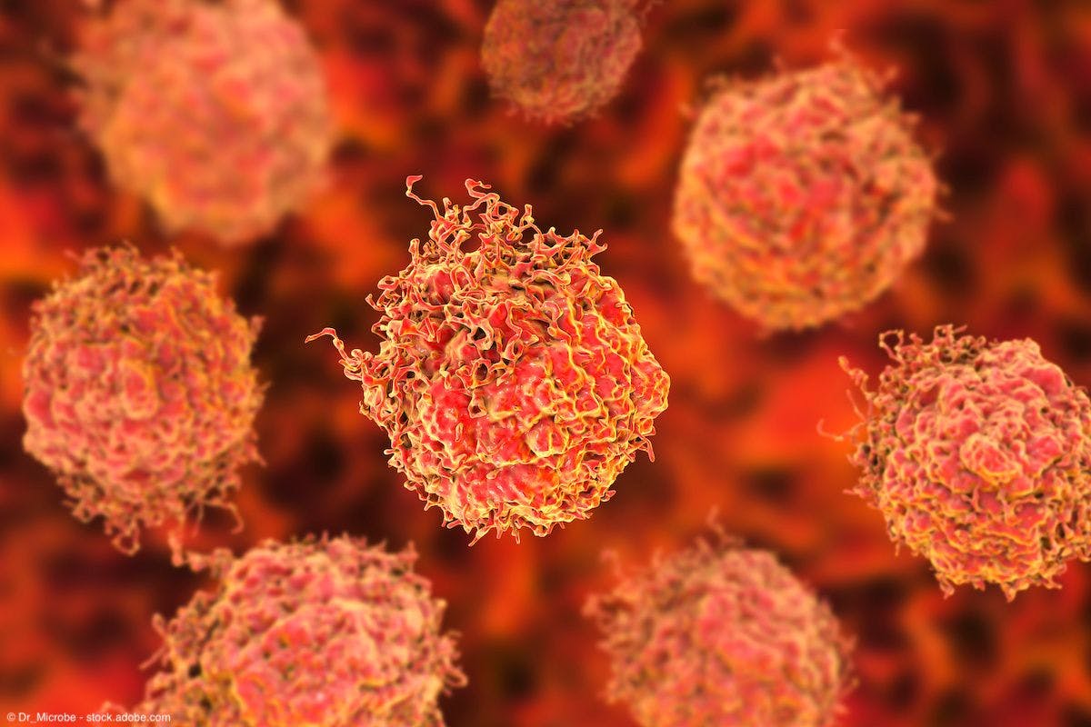 Studies explore resistance to hormone therapy in prostate cancer