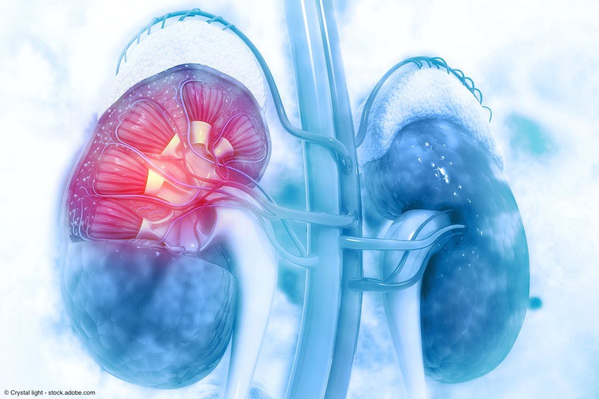 FDA grants Fast Track Designation to CAR T-cell therapy for kidney cancer